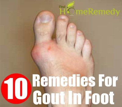 10 remèdes à la maison pour la goutte dans le pied