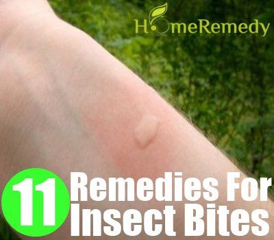 11 remèdes Distingués pour les piqûres d'insectes
