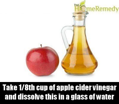 Apple Cider Vinegar1