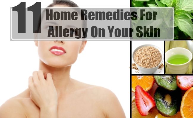 11 Remèdes maison pour l'allergie sur votre peau