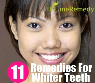 11 remèdes maison superbe pour des dents plus blanches