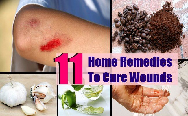 11 Sure Shot remèdes maison pour soigner les blessures