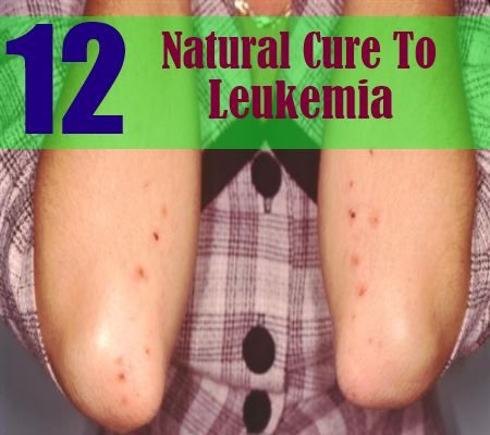 12 remède naturel à la leucémie