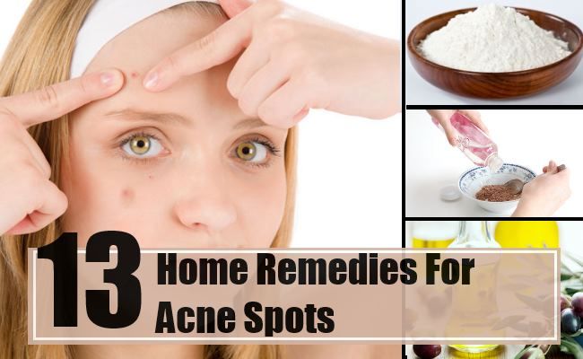 13 meilleurs remèdes maison pour les boutons d'acné