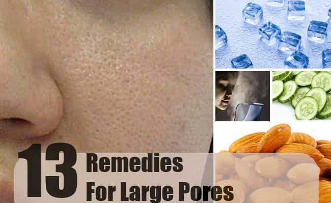13 remèdes à la maison pour de grands pores