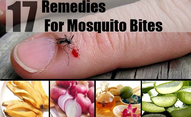 Remèdes pour les piqûres de moustiques