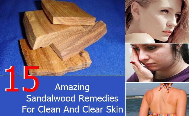 15 remèdes de bois de santal étonnants pour une peau propre et claire