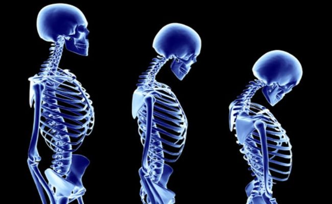 Efficace dans l'ostéoporose