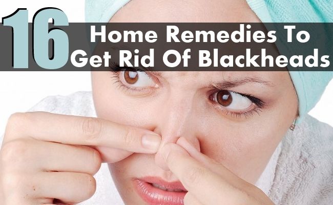 16 meilleurs remèdes maison pour se débarrasser des points noirs