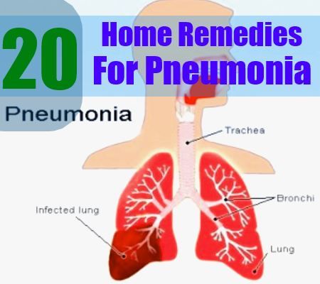 5 remède naturel pour une pneumonie