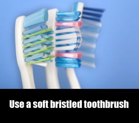Utilisez une brosse à dents à poils doux