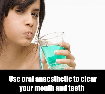 Anesthésie orale