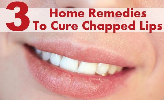 3 meilleurs remèdes maison pour guérir les lèvres gercées