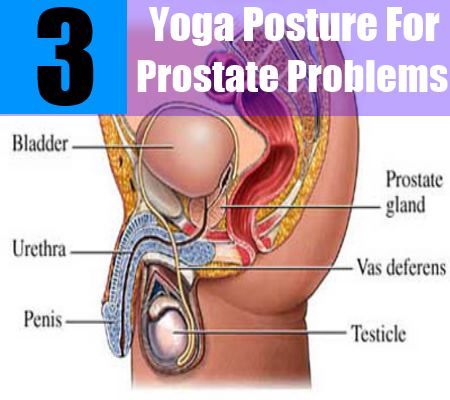 3 posture de yoga Pour les problèmes de prostate