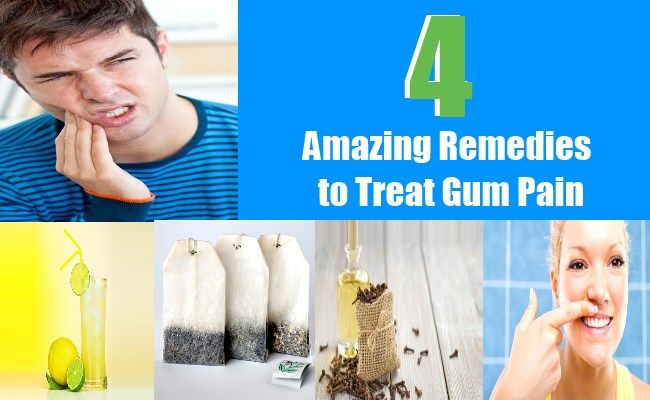 4 Remèdes étonnants pour traiter la douleur Gum
