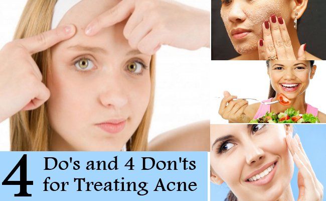 4 À faire et à ne pas faire 4 pour le traitement de l'acné