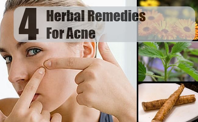 4 remèdes efficaces pour l'acné