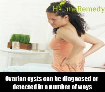 Diagnostic de kystes ovariens