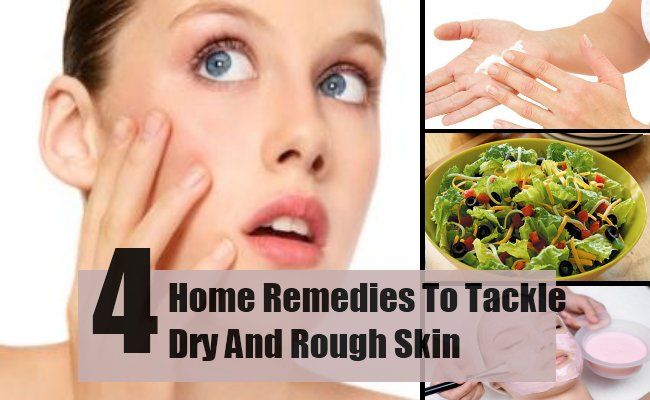 4 Accueil remèdes pour lutter contre la peau sèche et rugueuse