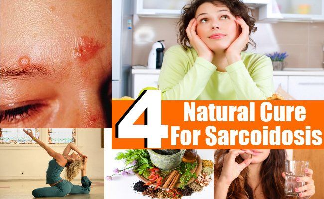 4 remède naturel pour la sarcoïdose