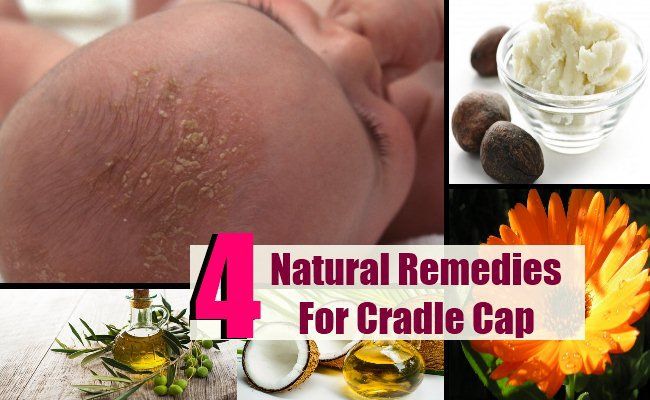 4 Remèdes naturels de confiance pour Cradle Cap