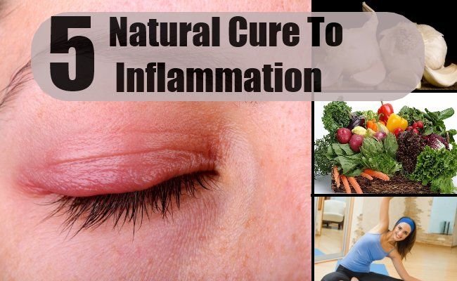 5 Meilleur remède naturel pour l'inflammation
