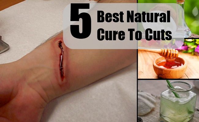 5 Meilleur remède naturel à des coupes
