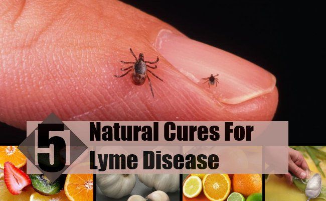 5 remèdes naturels pour la maladie de lyme