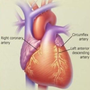 Maladie Cardiovasculaire