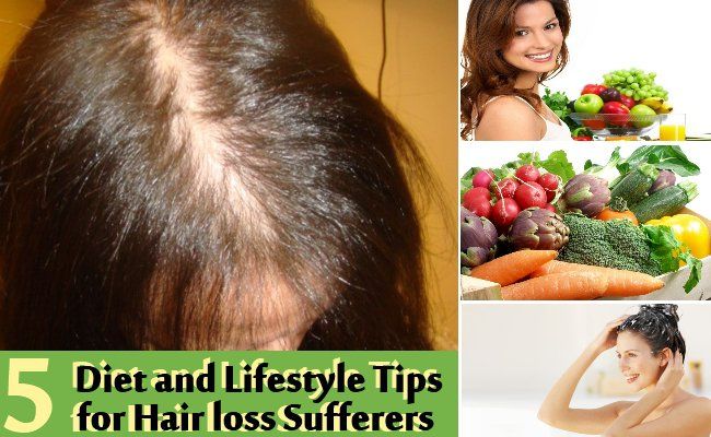 5 conseils diététiques et de style de vie pour les personnes souffrant de perte de cheveux