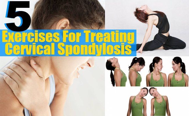 Exercices pour traiter cervicale Spondylose