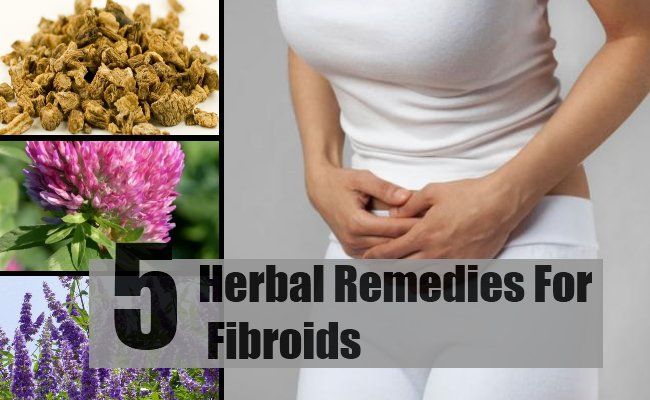 5 remèdes à base de plantes pour les fibromes