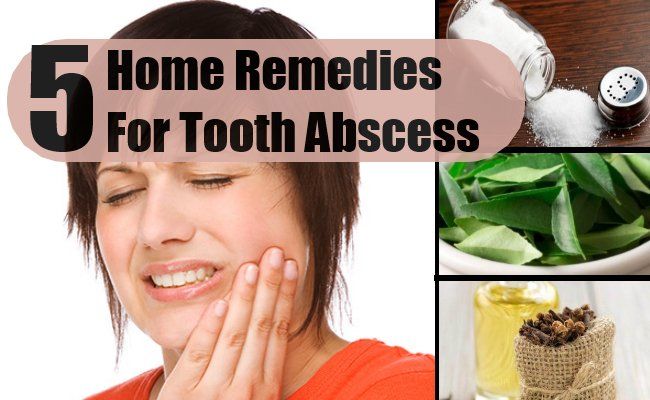 5 remèdes efficaces à domicile pour un abcès dentaire