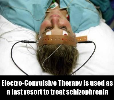 Thérapie Electro-Convulsive