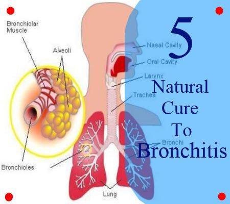 6 façons de guérir la bronchite
