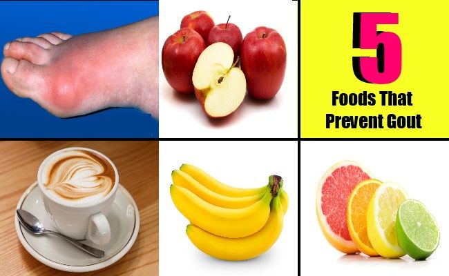 5 aliments qui prévenir la goutte