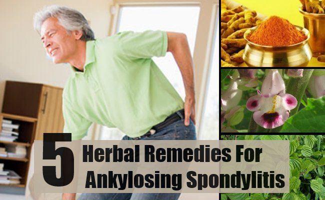 5 remèdes à base de plantes pour la spondylarthrite ankylosante