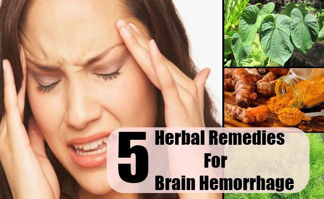 5 remèdes à base de plantes pour une hémorragie cérébrale