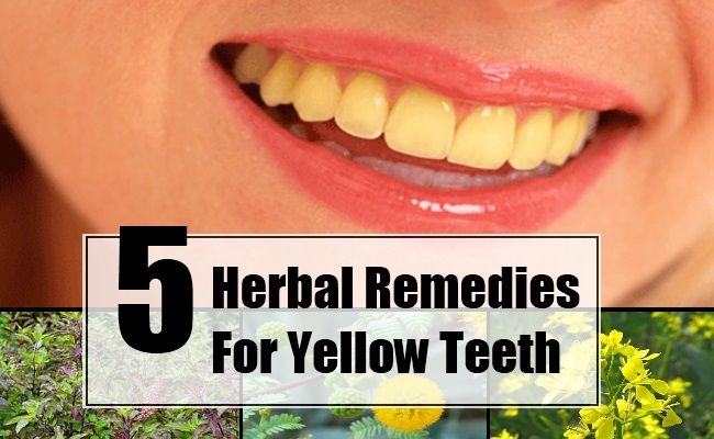 5 remèdes à base de plantes pour les dents jaunes