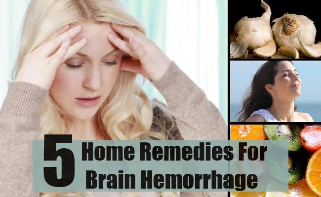 5 remèdes maison pour une hémorragie cérébrale