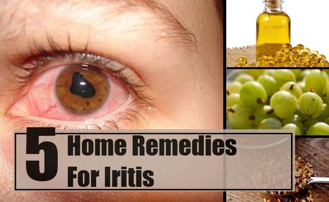 Remèdes pour Iritis