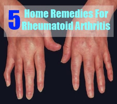 5 remèdes maison pour l'arthrite rhumatoïde