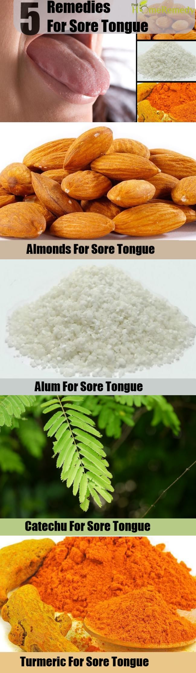 5 remèdes pour Tongue Sore