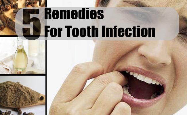 5 Accueil recours pour infection dentaire