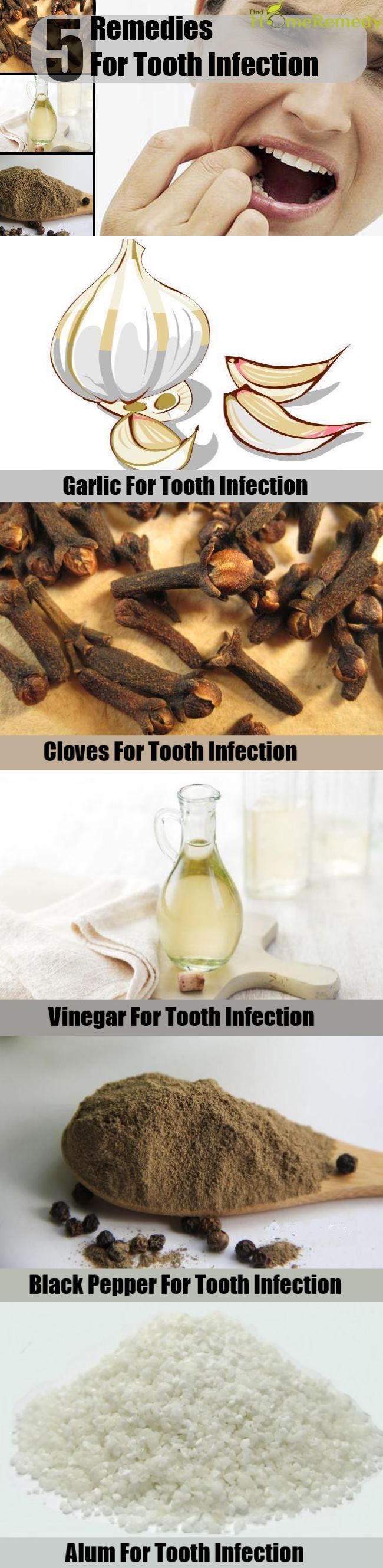 5 recours pour dent Infection