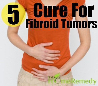 5 remède naturel pour les tumeurs des fibromes