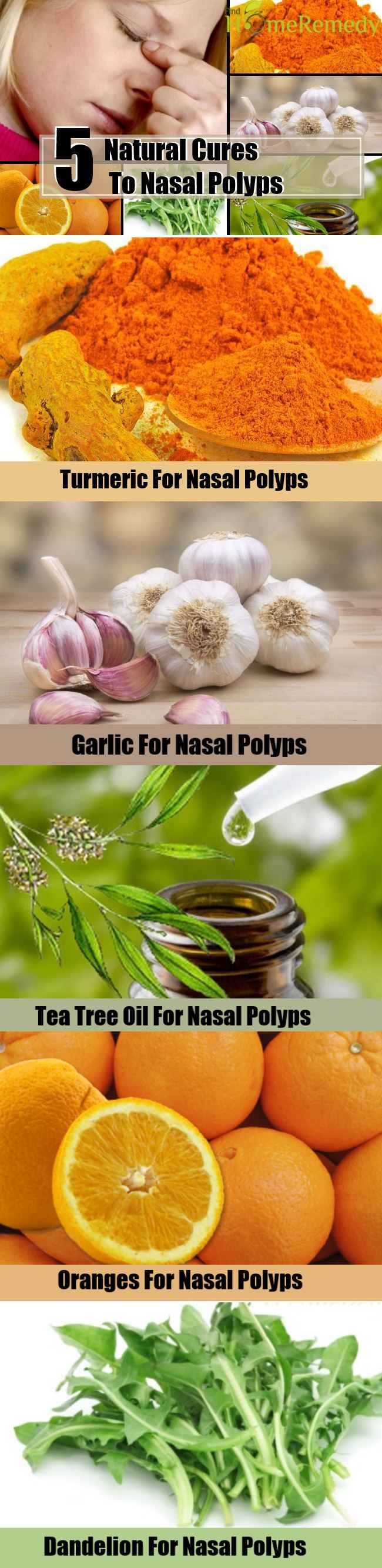 5 Natural Cures Pour polypes nasaux