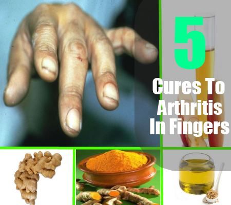 5 remèdes naturels à l'arthrite dans les doigts