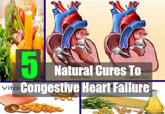 5 remèdes naturels à l'insuffisance cardiaque congestive