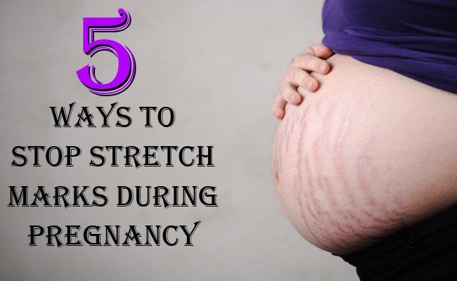 5 façons naturelles pour arrêter les vergetures pendant la grossesse